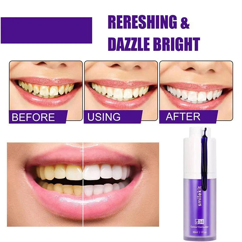 Whitening Toothpaste Remove Stains Reduce Yellowing Teeth Gums Fresh Breath - Supersell